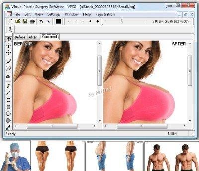 скачать Virtual Plastic Surgery Software-программа для виртуальной пластики